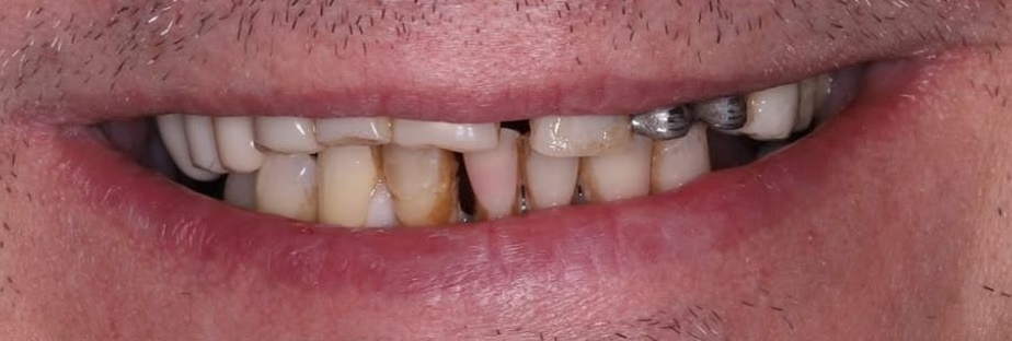 photo__before